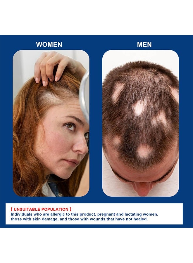 سوميفون كريم نمو الشعر الثعلبة لتعزيز نمو شعر الرجال للنساء ، ومنع تساقط الشعر ، والعناية بالشعر ، 20 جرام - Image 3