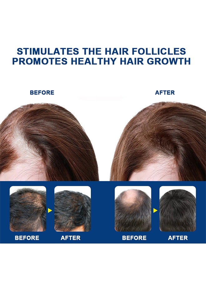 سوميفون كريم نمو الشعر الثعلبة لتعزيز نمو شعر الرجال للنساء ، ومنع تساقط الشعر ، والعناية بالشعر ، 20 جرام - Image 5