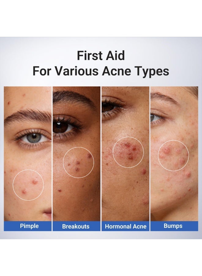 دكتور ليو سيروم بقعة حمض الساليسيليك 1.8% من دكتور ليو، علاج حب الشباب للبشرة الحساسة المعرضة لحب الشباب | نياسيناميد، تخفيف البثور بسرعة، يتلاشى علامات حب الشباب، بين عشية وضحاها وفترات الحيض، 0.33 اونصة سائلة - Image 5