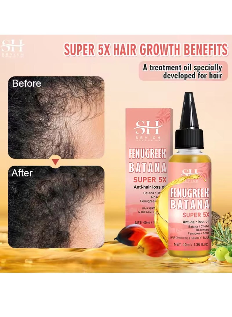 Sevich 5X Rapid Hair Growth Oil with Batana Chebe Rosemary Fenugreek and Amla Oil Hair Growth Oil and Scalp Treatment Super 5 in 1 Oil Anti Hair Loss Oil and Hair Regrowth Scalp Treatment Oils - Image 4
