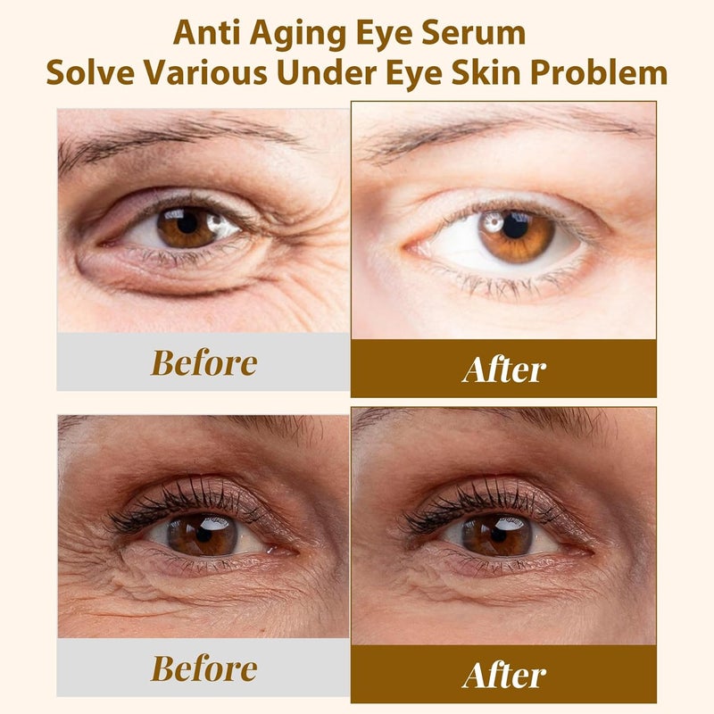 EJW Revive Eye Serum with Gentle Retinoid Correction for Under Eye Bags Wrinkles Puffiness Fine Lines and Crows Feet Hydrating Firming AntiAging Elevates Radiance and Revives Skin 05 oz - Image 3