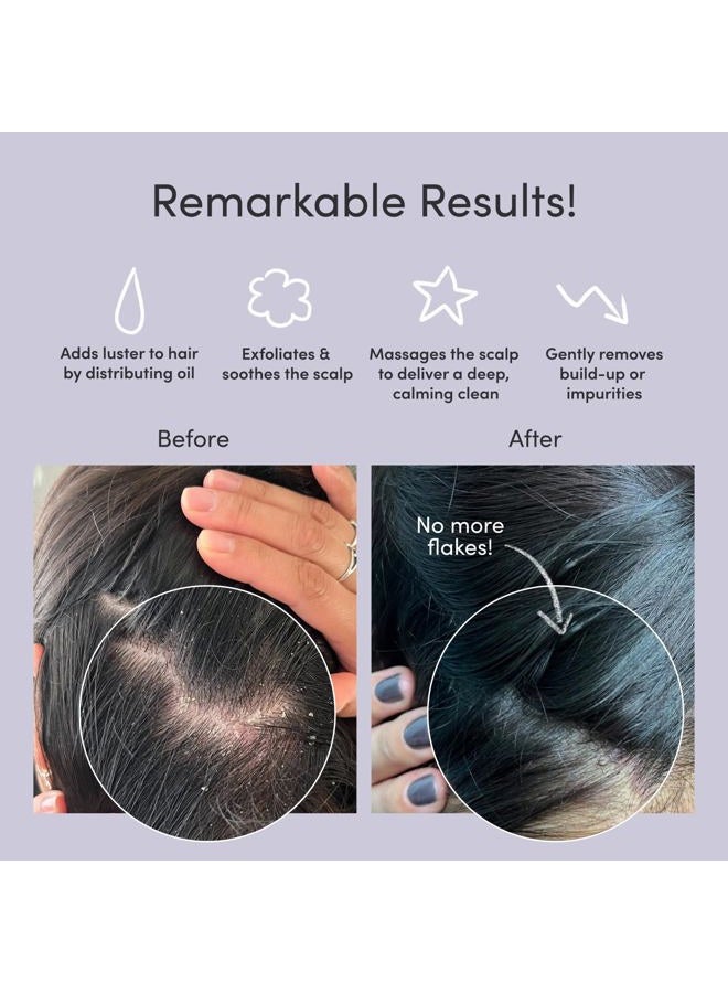 Jupiter Exfoliator Brush, for Removing Dandruff & Build-Up, Detangling Scrubber, for Wet or Dry Hair, Supports Circulation & Growth, for All Hair Types, Black - Image 2