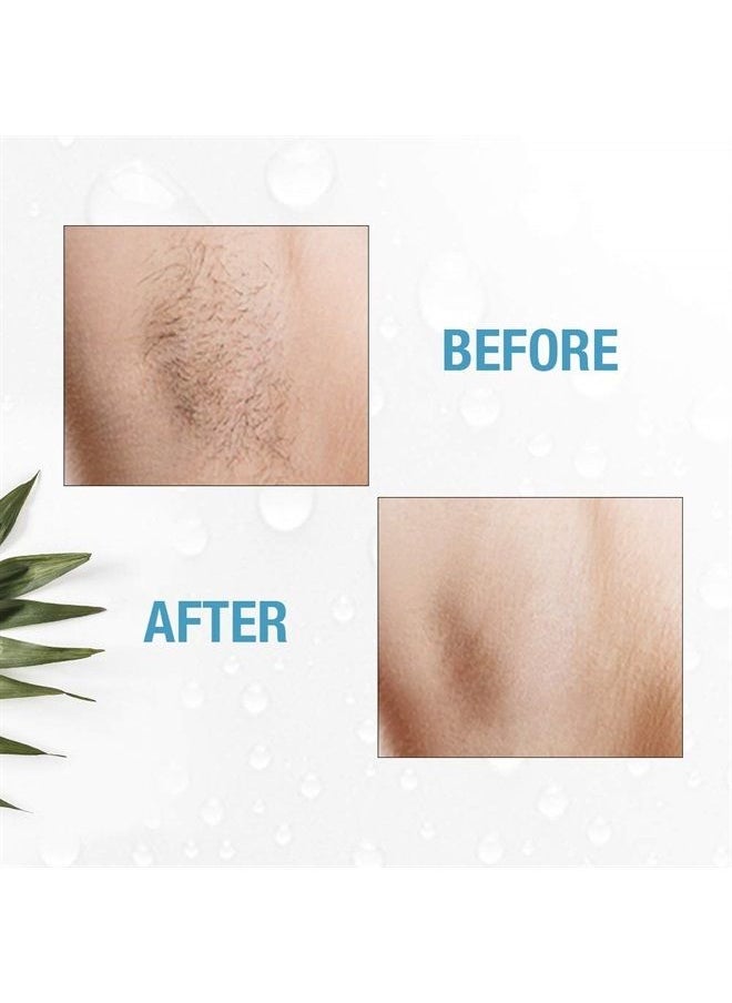 Clean + Easy - Non-Laser Personal Electrolysis for Face and Body, Permanent Hair Removal - Battery Operated - Image 1