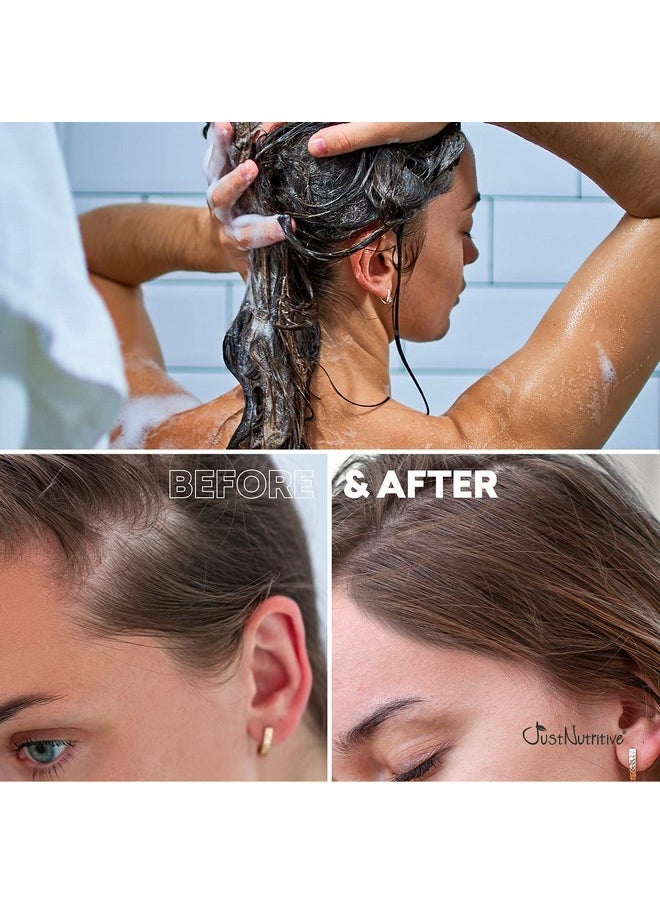 Just Nutritive Hair Loss Shampoo | Hair Regrowth Shampoo For Thinning Hair | Hair Growth Product For Men and Women | Just Nutritive | 16 Oz  - Image 3