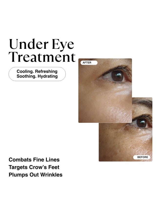 MATKAS Korean Retinol Eye Cream For Dark Circles And Puffiness Wrinkles Fine Lines Anti Aging Night Under Eye Cream Niacinamide Turmeric Root 6 Types Of Ceramides Hyaluronic Acid - Image 2