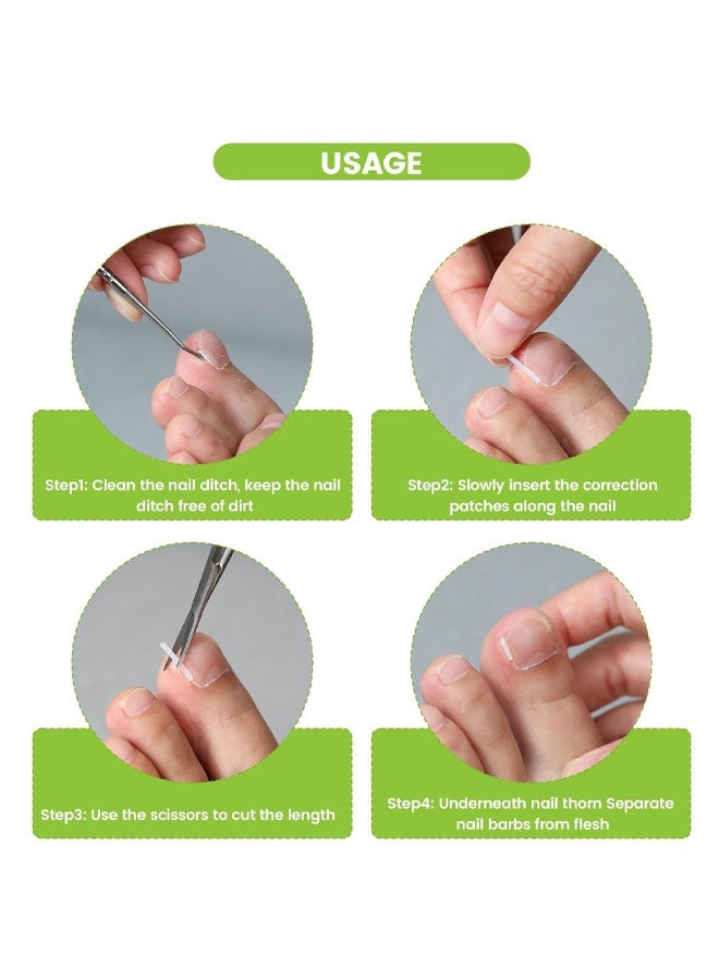 50 Ingrown Toenail Filler Sleeves Orthognathic Pads C-Shaped Nail Groove Pads Ingrown Toenail Correctors Pedicure Tools - Image 5