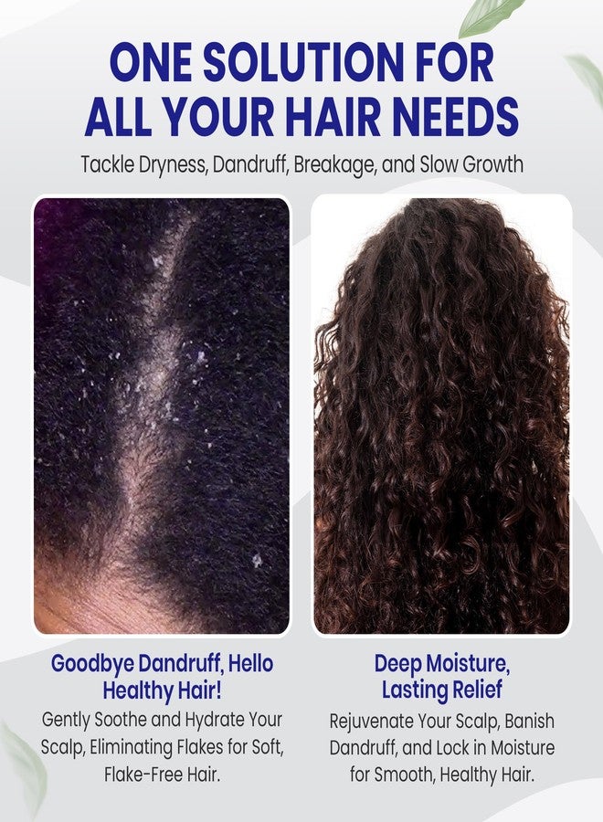 BIOCARE - Rosemary, Tea Tree, and Castor Oil - Hair Growth Oil, Strength, and Faster Growth - 4 oz - Image 5