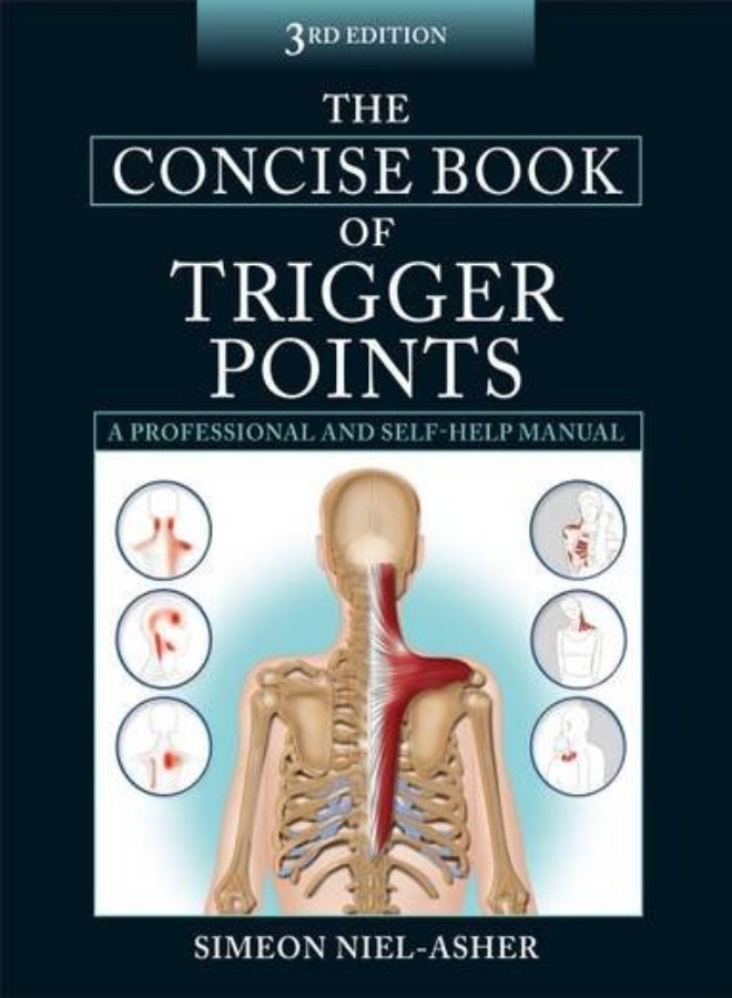 The Concise Book of Trigger Points 