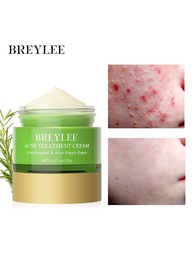 Breylee Acne Treatment Cream, Acne Removal Acne Pimple Repair Cream, Natural Cystic Acne Treatment, Premium Acne Scar Cream And Pimple Remover, 20G - Image 1