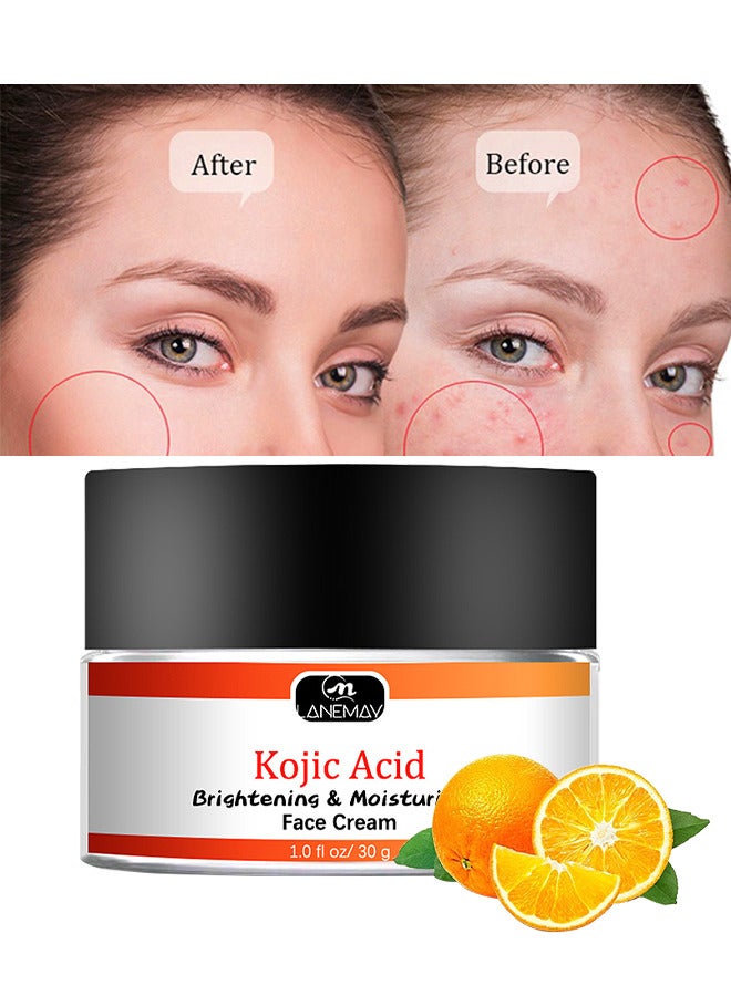 لينماي كريم الوجه بحمض كوجيك 30 جم ، ترطيب وتفتيح البشرة ، اختراق عميق خفيف الوزن غير دهني مضاد للشيخوخة ، بقع أو ندبات حب الشباب بطريقة فعالة - Image 1