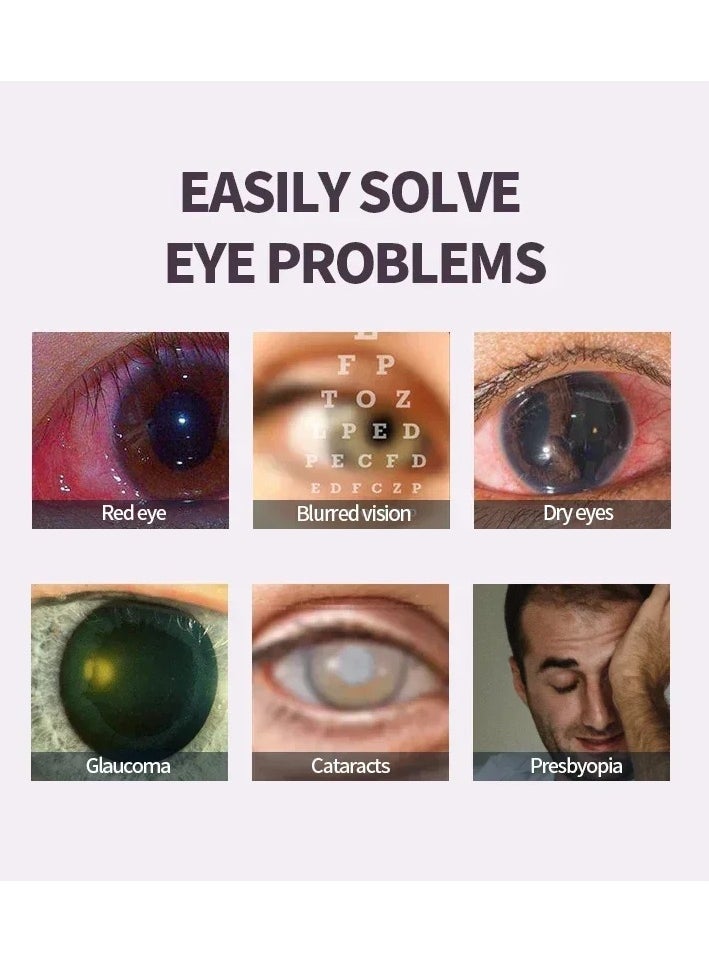 AS SEEN ON TV Cataract Treatment Eye Drops, Natural Ingredients Eye Pain Relief Essence, Safe Effective Red Eyes Eye Drop Solution, Eye Liquid For Blurred Vision Dry Itchy Eyes Blurred Vision And Eye Redness  - Image 4