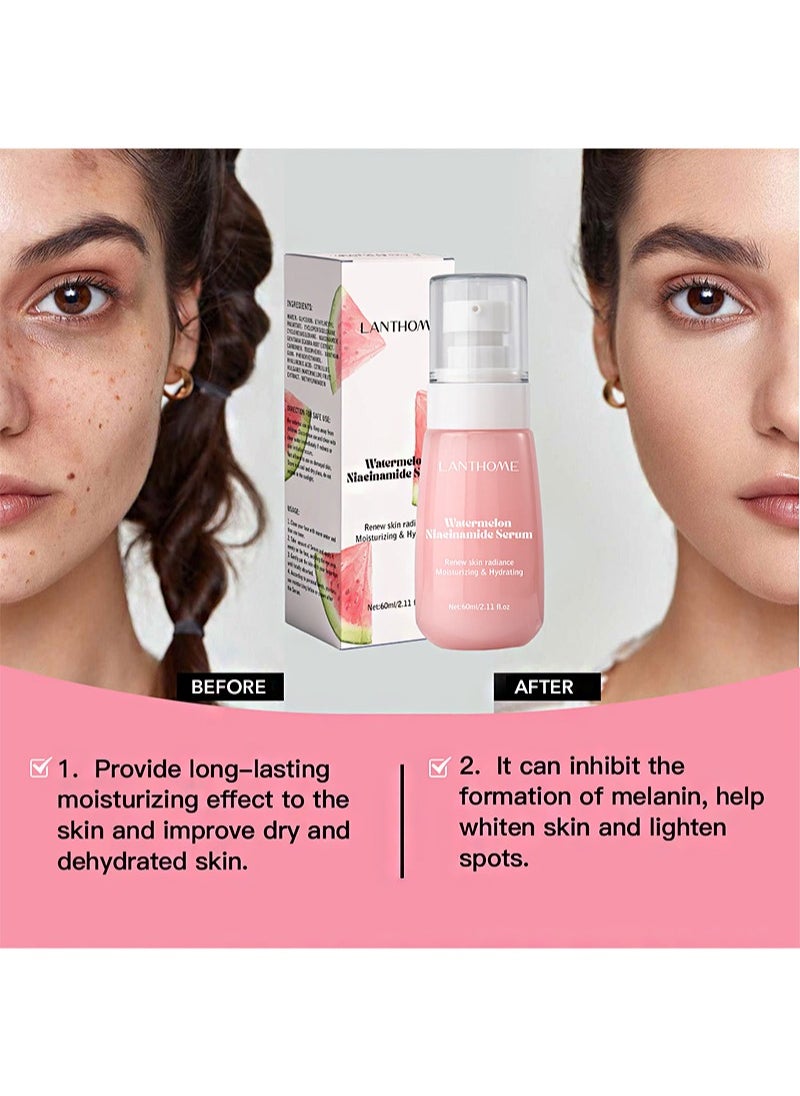 Lanthome - Watermelon Niacinamide Serum，Face Skin Care, Hydrating & Brighten with Hyaluronic Acid, Glycerin and Vitamin E, Lightweight Facial Serum & Priming Liquid Highlighter(60ml) - Image 1