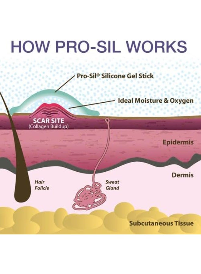 PROSIL Kids Pro-Sil 4.25g Silicone Stick for Scars - Image 5
