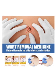Excefore 3Pcs wart Remover,plantars wart Remover for feet,Hand wart Remover,Warts Remover,wart Removal Products,eliminador de verrugas,wart Remover Freeze Off,wart Removal Cream  - Image 2