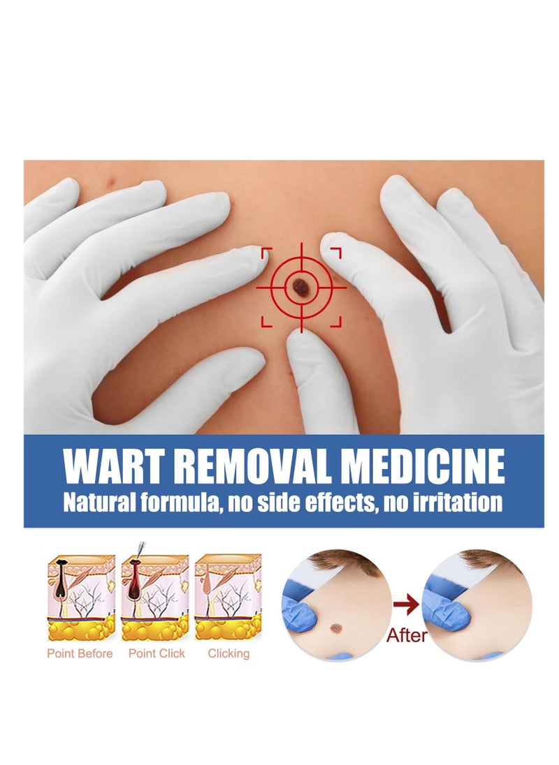 Excefore 3Pcs wart Remover,plantars wart Remover for feet,Hand wart Remover,Warts Remover,wart Removal Products,eliminador de verrugas,wart Remover Freeze Off,wart Removal Cream  - Image 2