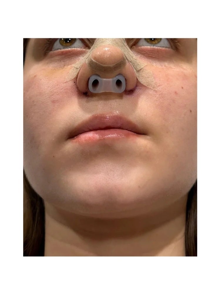 (No. 7  No. 8)Face healthly Silicone Nostril Retainer, Nose Pad for Surgery, Nose Retainer Rhinoplasty, Retainer for Work Surgery,%100 Silicone Nose Stud - Image 4