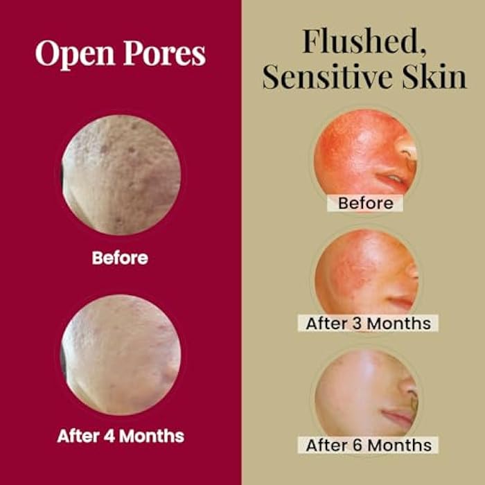 LABO Nutrition Le Revital Concentrated Nano Placenta Extract Serum Essence from Japan – Hydrating, Glowy, Moisturizing for Face Wrinkles, Dull Skin, Tone, Soothing & Skin Barrier Strength | 4 Vials - Image 4