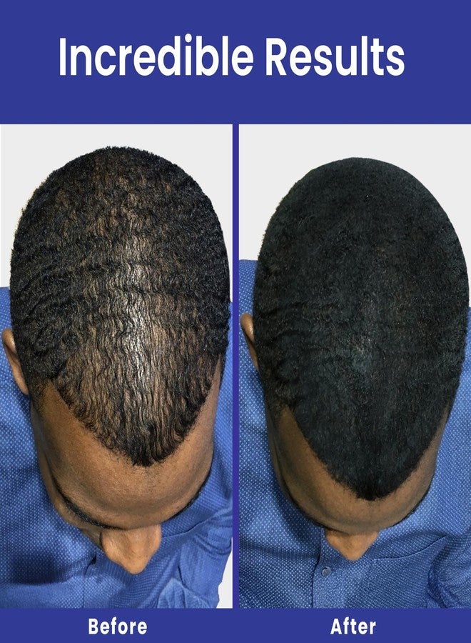 إينفينيتي ألياف إنفينيتي للشعر البني الداكن للشعر الخفيف للنساء والرجال - بودرة ألياف بناء الشعر غير مرئية بنسبة 100% - تخفي تساقط الشعر في 15 ثانية، 30 غرام - Image 4