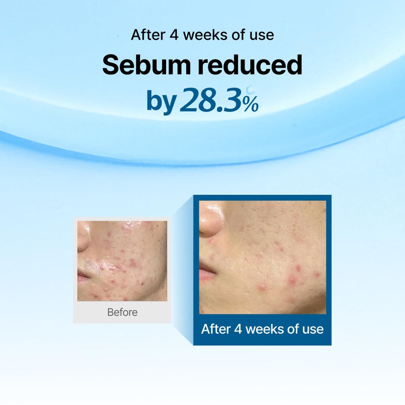 ديركلايرز قطرة ميدنايت بلو لتجديد شباب البشرة - Image 3