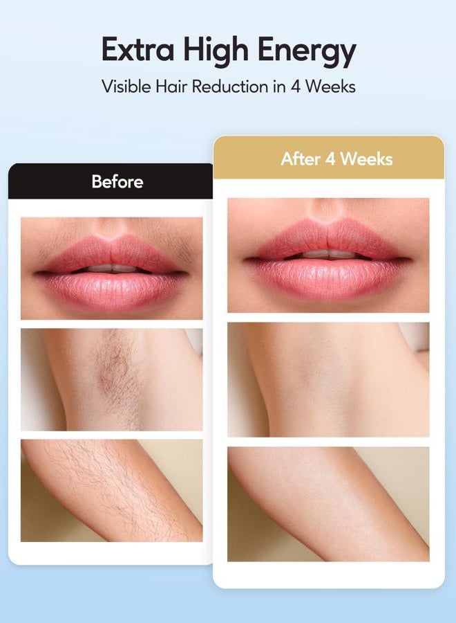 innza IPL Hair Remval Device with Ice Cooling Function,999999 Flashes 9 Level Painless Long Lasting Hair Remover System for Facial,Bikini,Body - Image 4
