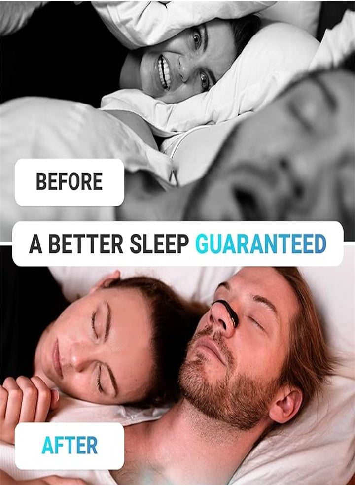 General 30pcs Air Intake Breathing Nose Patch, Sleep Anti-Snoring Nose Patch, Breathing Nose Patch, Long-lasting Anti-Snoring Device, Suitable for Business Travel, Tourism, Hotel and Home (Black)  - Image 3