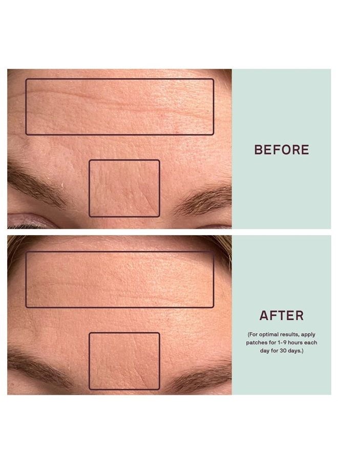 Silicone Face Patches for Wrinkles & Fine Lines - Silicone Fusion Treatment Anti-Wrinkle Patches for Pregnancy Safe SkinCare - Reusable Under Eye, Forehead & Face Wrinkle Patches