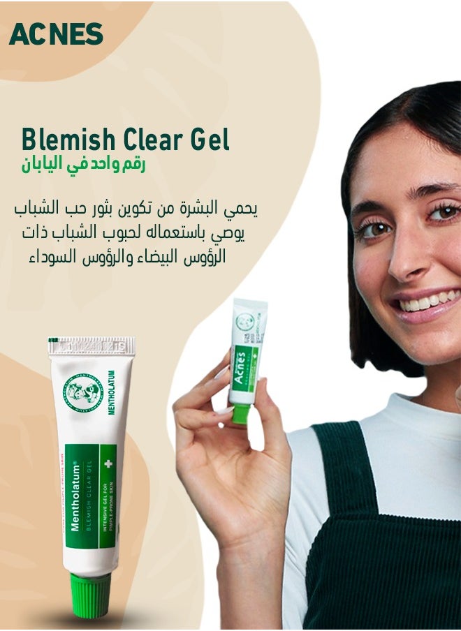 مينثولاتوم - منتولاتم أكنس جل لعلاج حب الشباب 9 جم - Image 1