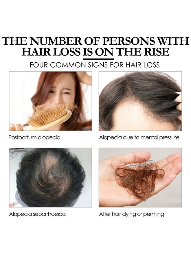 إيلهو زيت باتانا - زيت باتانا لنمو الشعر - زيت باتانا عضوي لشعر صحي - يصلح الشعر التالف ويغذي الشعر الرقيق وبشرة فروة الرأس وتساقط الشعر التنوب لجميع أنواع الشعر - 30 مل - Image 3