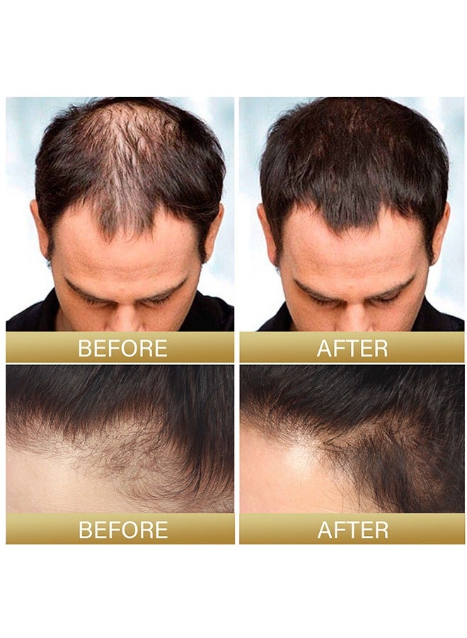 إيلهو زيت باتانا - زيت باتانا لنمو الشعر - زيت باتانا عضوي لشعر صحي - يصلح الشعر التالف ويغذي الشعر الرقيق وبشرة فروة الرأس وتساقط الشعر التنوب لجميع أنواع الشعر - 30 مل - Image 5