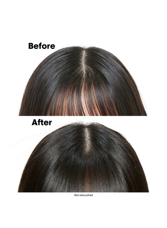 لوريال بروفيسيونال شامبو للشعر الدهني - Image 4