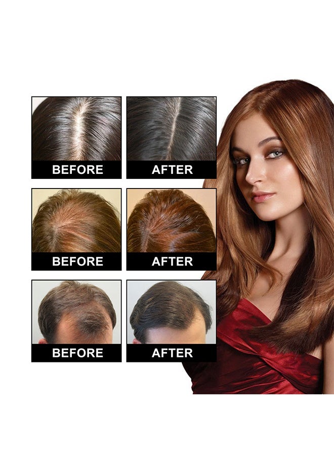 بورك زيت أساسي بالكثافة الطبيعية ، علاج مصل نمو الشعر بمثخن نمو الشعر بالزيت سريع النمو للشعر للعناية بتساقط الشعر (35 مل) - Image 5