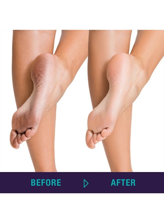 TRIM Simply Foot 4-in-1 Foot Paddle – Include Metal Foot Rasp, Pumice Stone, Foot Brush, and Abrasive Surface – Easy to Use Foot Care Tools for DIY Pedicures – Ideal for Men and Women – Teal - Image 5