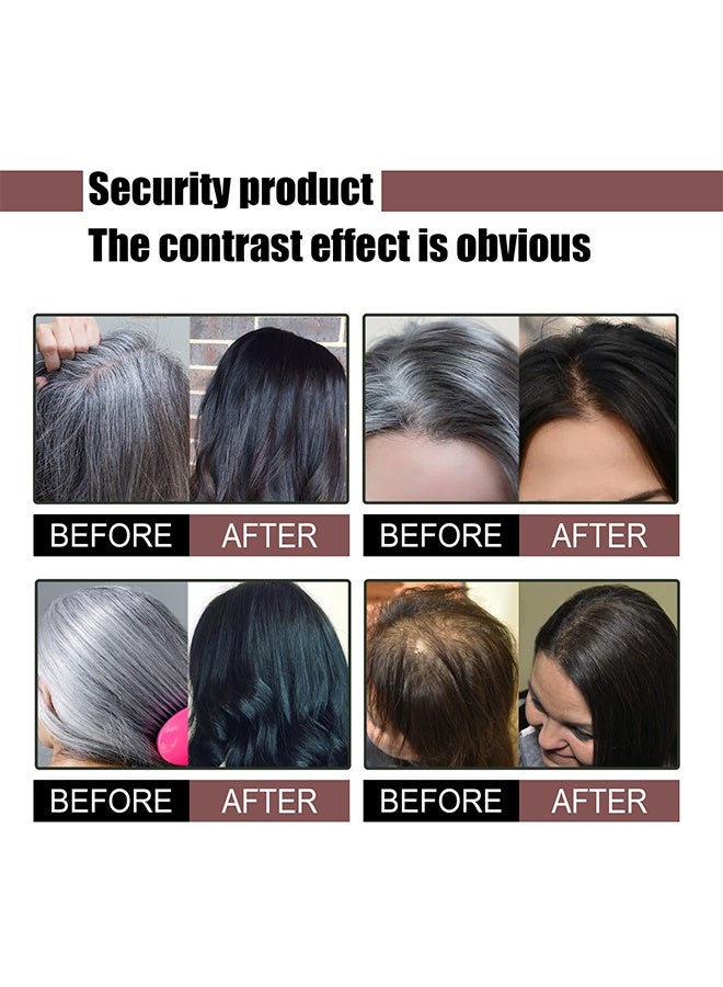 YURHERSU Natural Darkening-Polygonum Multiflorum Shampoo Soap100g ，Black and Thick Hair Polygonum Soap Bar, He Shou Wu Shampoo Soap, Natural Polygonum Hair Soap, Promotes Hair Growth and Prevents Hair Loss - Image 5