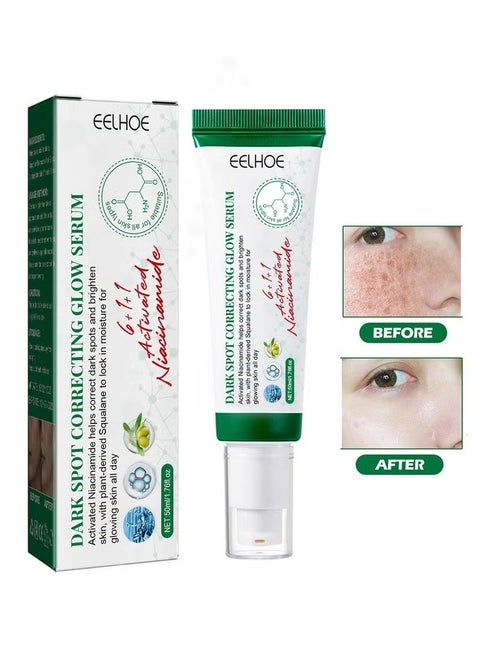 Dark Spot Correcting Glow Serum, Moisturizing Whitening Brightening Serum, Dark Spot Treatment, Repair Dullness, for Acne Scars, Fine Lines, Hyperpigmentation and Dark Circles 50ml