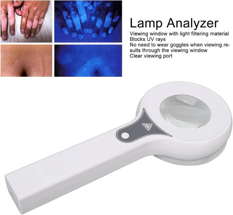 klarako Woods Lamp Skin Analyzer, 2 Gear Handheld Accurate Portable Magnifying Analyzer Machine for Skin Diagnosis Cat Dog Pets Face Skin Care - Image 4