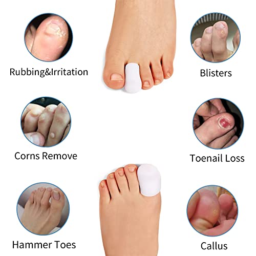 Anzailala Toe Protectors for Men Women Soft Gel Toe Caps for Foot Pain Relief Toe Separator Toe Sleeves for Ingrown Toenails Corns Calluses Blisters - 2 Large + 4 Small (L, 6) - Image 2