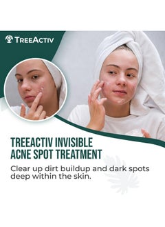 TreeActiv TreeActiv Invisible Salicylic Acid Cystic Acne Treatment For Face Original Formula, 0.5 fl oz, Acne Face Cream, Acne Spot Treatment for Face & Body, Acne Clearing Cream Moisturizer for Teens & Adults  - Image 2