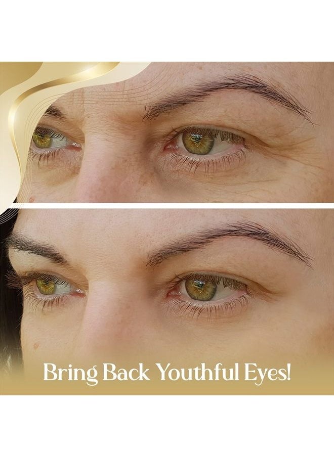 Orogold OROGOLD 24K Intensive Eye Serum for Wrinkles, Puffiness - Anti Aging Serum For Youthful Looking Skin - Under Eye Skin Softening Serum - 50 ml. / 1.76 fl. oz.  - Image 2