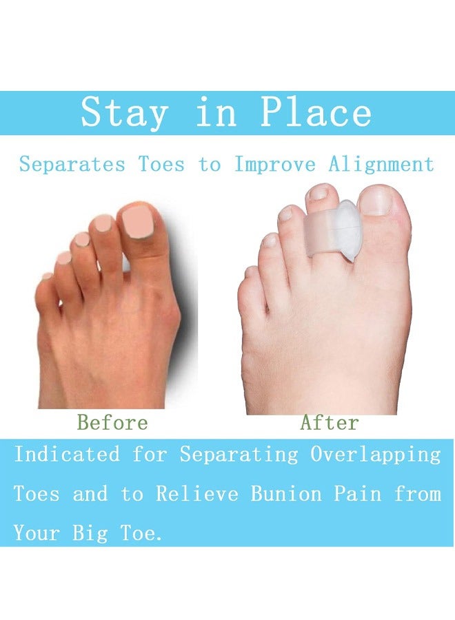 Toe Spacers Gel Applicator Correction Crooked - Bunion Braces And Bunion Relief, Pads for Overlaps - 4 Pack - Image 2