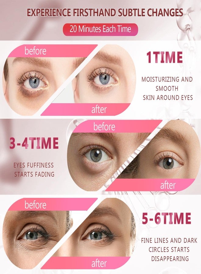 Yargkos 60 Pcs Pink Under Eye Patches, 30 Pairs Undereye Mask for Puffy Eyes Dark Circles Treatment, Collagen Gel Pads Hydrating for Eye Bags Puffiness Wrinkle, Women Men Beauty Skin Care Products - Image 5