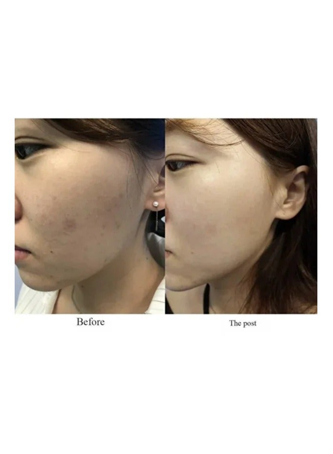 Axis-Y Dark Spot Correcting Glow Serum - Radiant Skin with Even Tone - Brightens and Fades Dark Spots - Image 4