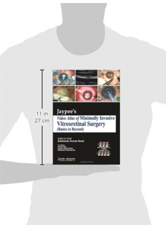 Jaypee’s Video Atlas of Minimally Invasive Vitreoretinal Surgery (Basics to Beyond)  - Image 2