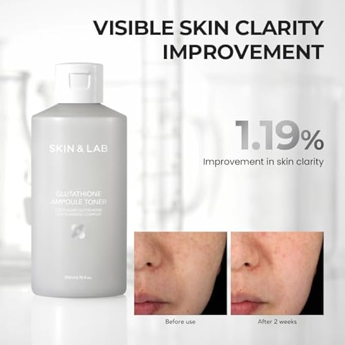SKIN & LAB SKIN SCIENCE SOLUTION [Skin&LAB] Glutathione Ampoule Toner 6.76 fl oz, Improve Dart Spot, Hyperpigmented, Skin Clarity, Korean Toner for Sensitive Skin - Image 5