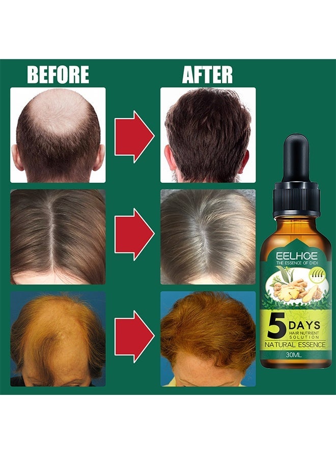 إيلهو محلول مغذي للشعر ، لتساقط الشعر وإعادة نمو الشعر وفروة الرأس ، علاج زيت الزنجبيل الأساسي يدعم علاج ترقق الشعر الصحي زيت نمو الشعر للرجال 30 مل - Image 5