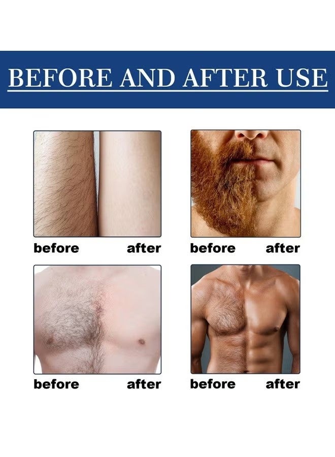 East Moon Hair Removal - Hair Removal Mousse Foam Spray For Men, Painless Hair Removal Spray Armpit Gentle Hair Remover Refreshing Quick Hair Removal Spray, Safe Hair Depilatory For Male Underarm, Chest, Back, Legs 100ML - Image 5