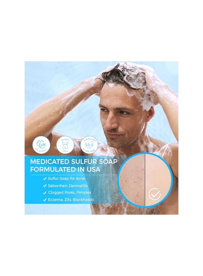 OUKEYA Sulfur Soap for Face Acne Treatment with Sulfur 10%, Salicylic Acid 2%, Goat Milk, Tea Tree, Hia Acid,Pharmaceutical Grade Dermatologists - Image 3