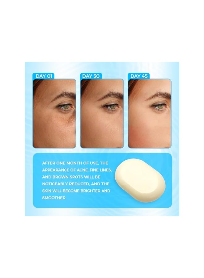 OUKEYA Sulfur Soap for Face Acne Treatment with Sulfur 10%, Salicylic Acid 2%, Goat Milk, Tea Tree, Hia Acid,Pharmaceutical Grade Dermatologists - Image 4
