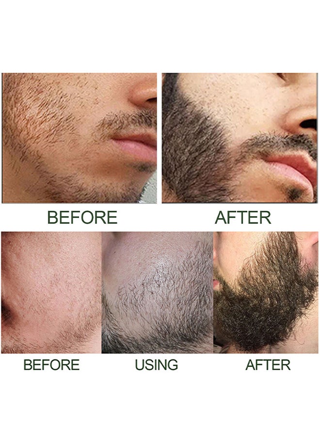 East Moon - Beard Growth Serum Hyper Derma Roller, Men Rosemary Oil Moustache Growth Enhancer ​Anti Hair Loss Care Serum With Beard Rolle 60ML - Image 1