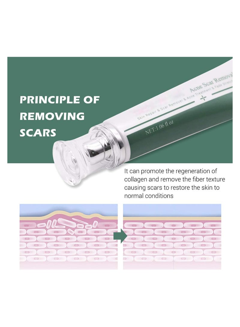 Breylee Acne Scar Removal Cream 30grams - Image 3