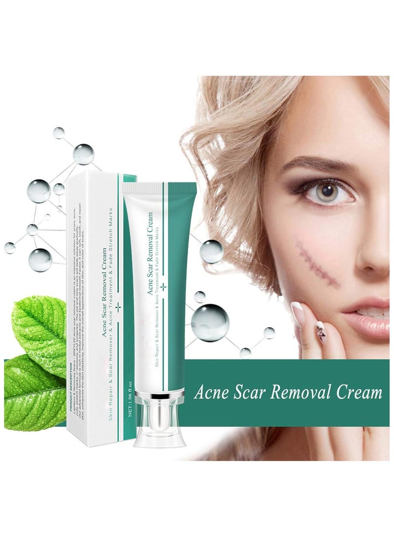 Breylee Acne Scar Removal Cream 30grams - Image 4